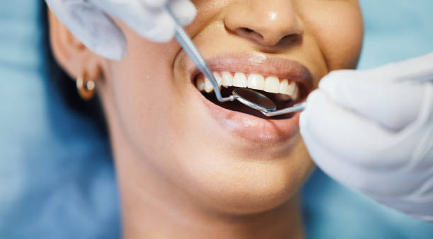 Best Lost Filling or Crown Replacement in Linden, NJ