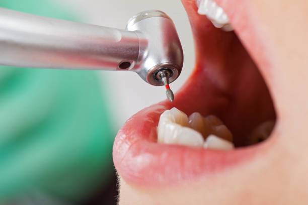 Best Emergency Treatment for Oral Infections in Linden, NJ